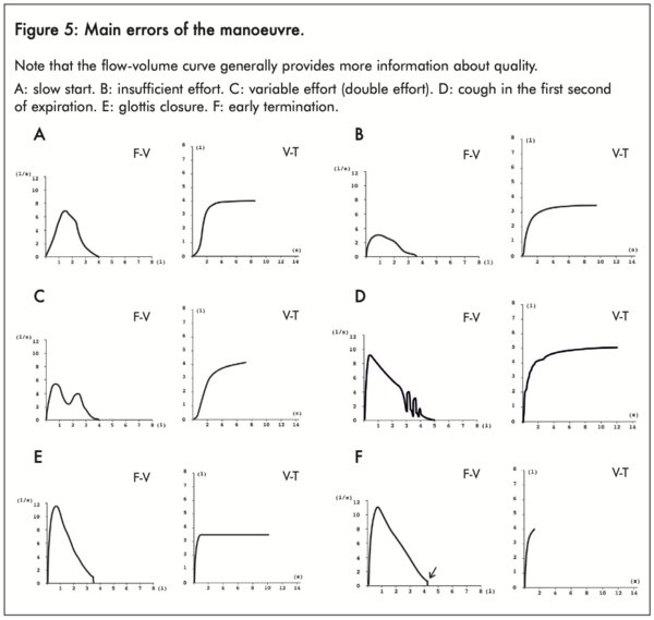 Figure 5: Main errors of the manoeuvre - click to enlarge Figure 5: Main errors of the manoeuvre - click to enlarge